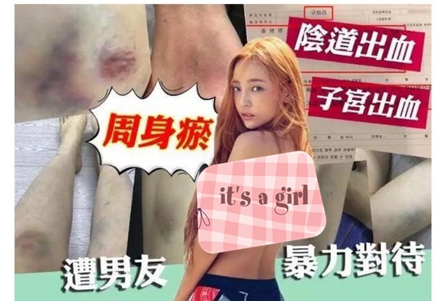 28岁韩女星具荷拉猝然离世，生前遭家暴、偷拍不雅视频，还被网暴