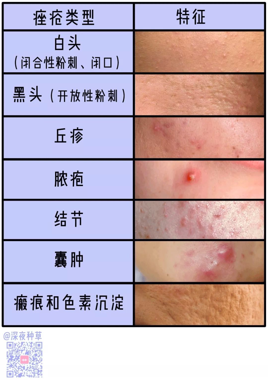 我被祛痘机构骗了上万块，好绝望…