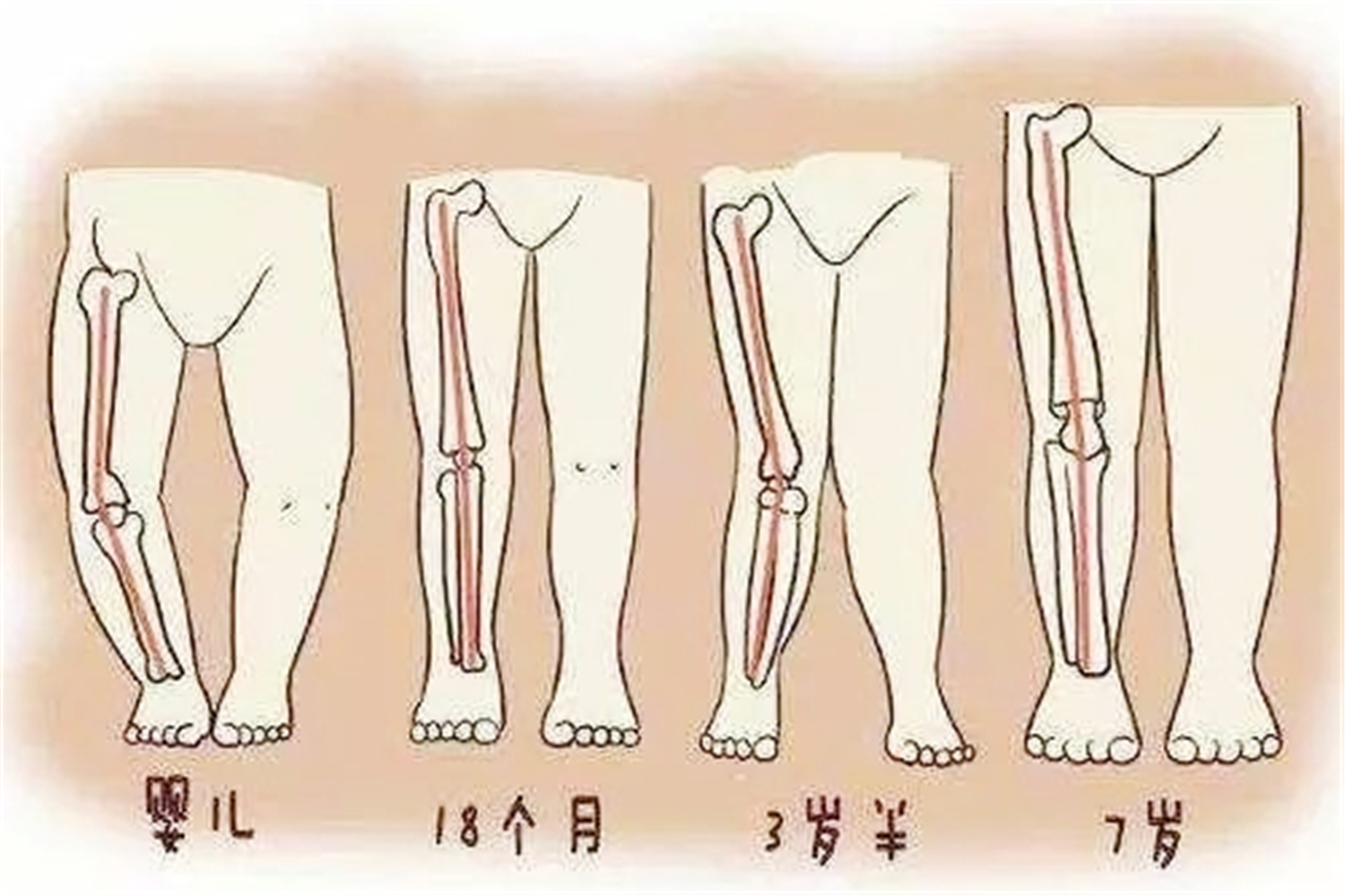 每天10分钟【收获细直女团腿】拯救各种腿型不直，带练帮你矫正O型腿|X型腿|XO型腿|小腿外翻|瘦腿-bilibili(B站)无水印视频解析——YIUIOS易柚斯