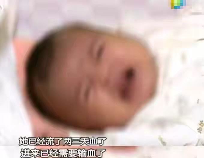 婴儿拉血丝跟母乳有关（2个月宝宝脑出血）