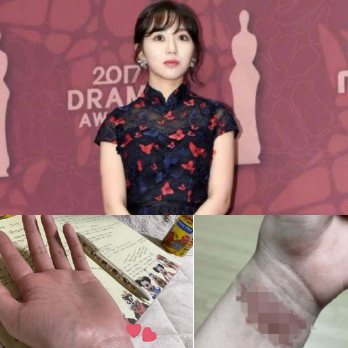 韩国一女星自爆：自杀20次未遂背后，从小就在经历痛苦