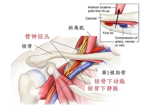 锁骨太过饱满，摸起来还很硬？很可能是你这长了肿瘤