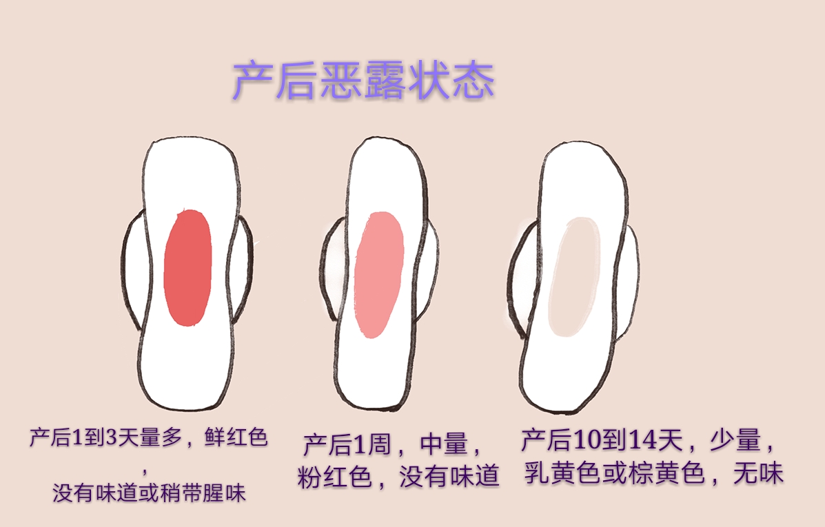 产后恶露应该怎么办？