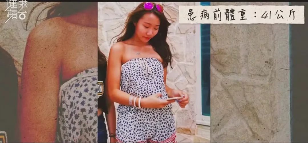 00后英国留学患病暴肥19kg，停止减肥才是出路？