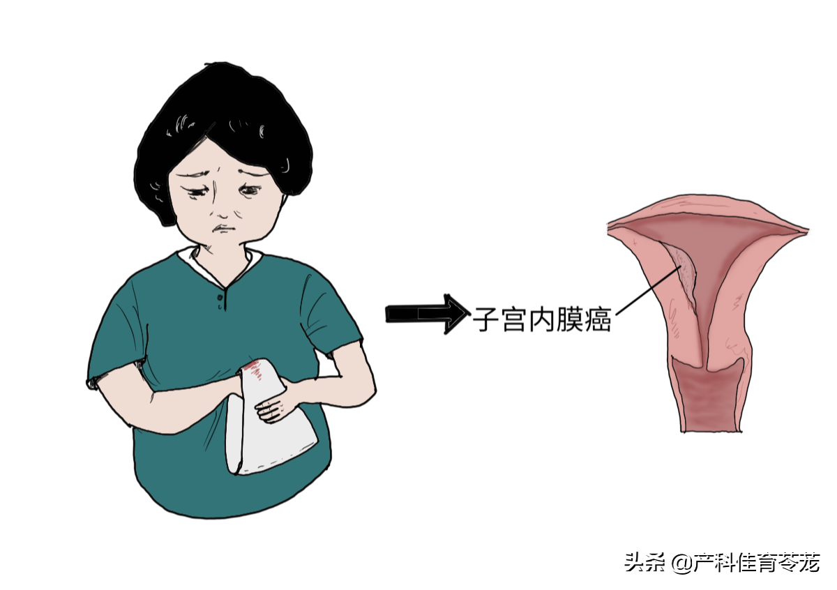 月经老不干净，年龄不同，病因不同