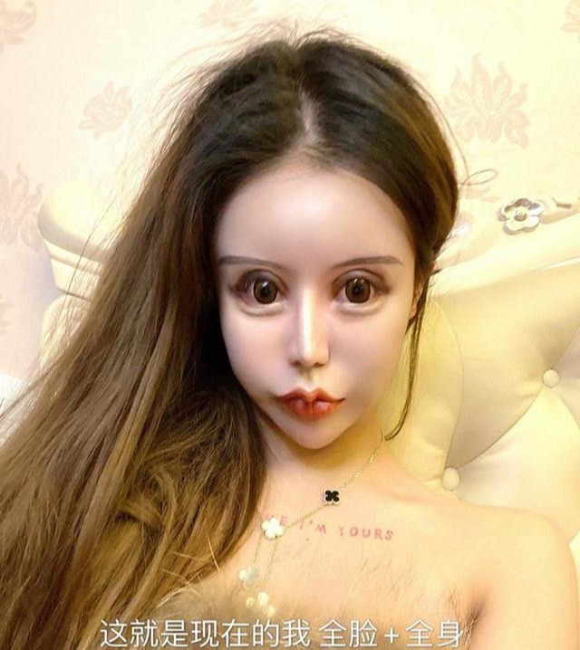 15岁女孩花四百万整形百次,与整容相比,更需要整的是"人心"