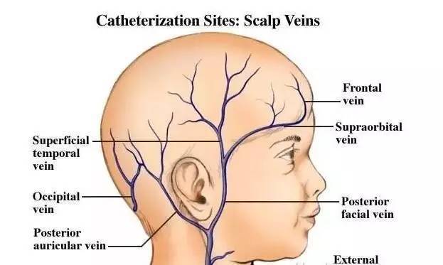 宝宝带有静脉留置针，妈妈在家护理10要点，让宝宝少疼痛更安全