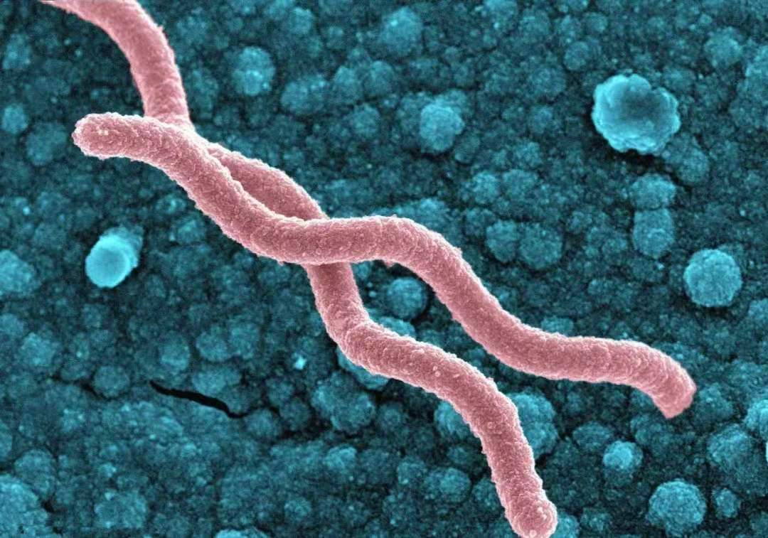 组织胞浆菌病,由真菌感染引起的传染病,预后情况取决于病情轻重