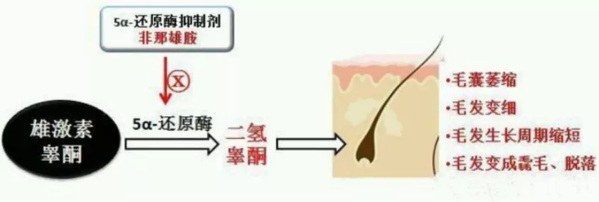 脱发人士必看:拯救发量的N个办法,到底哪个最靠谱?
