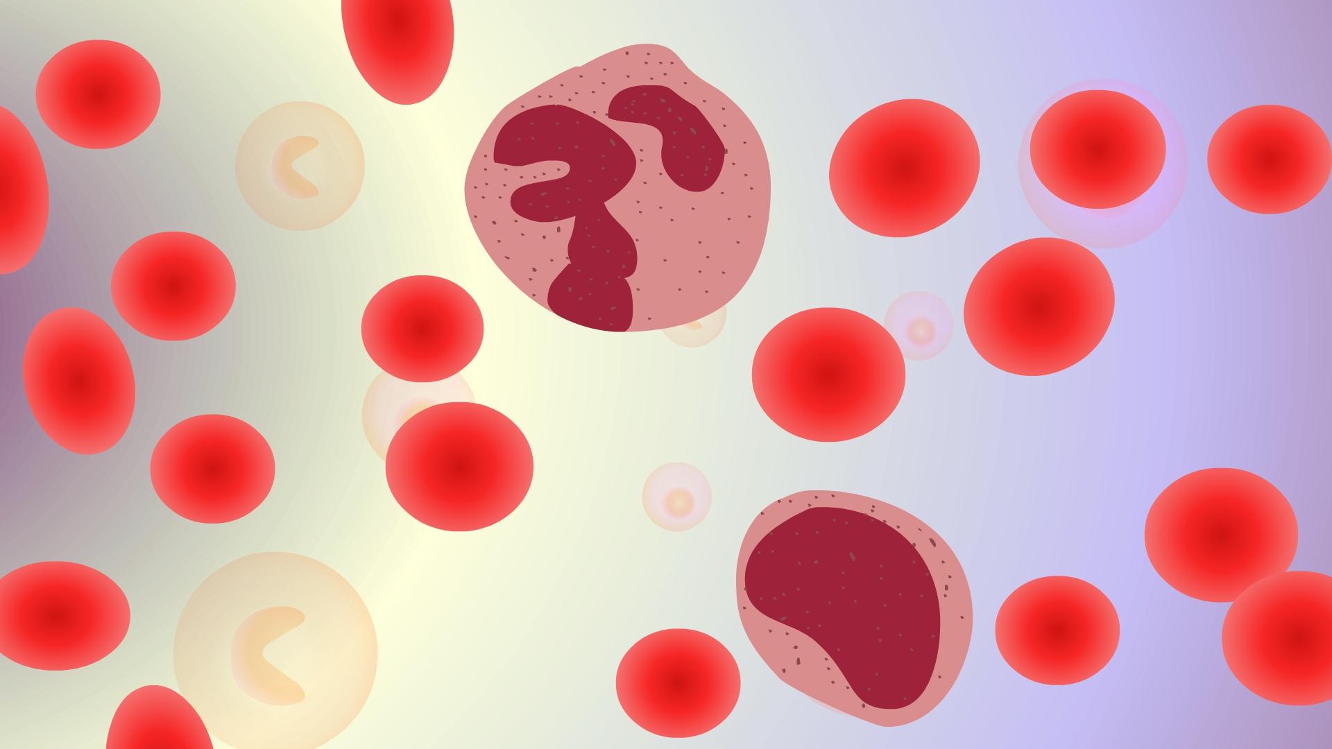 嗜血细胞综合征,典型症状不易被发现,可能会影响患者肺部健康