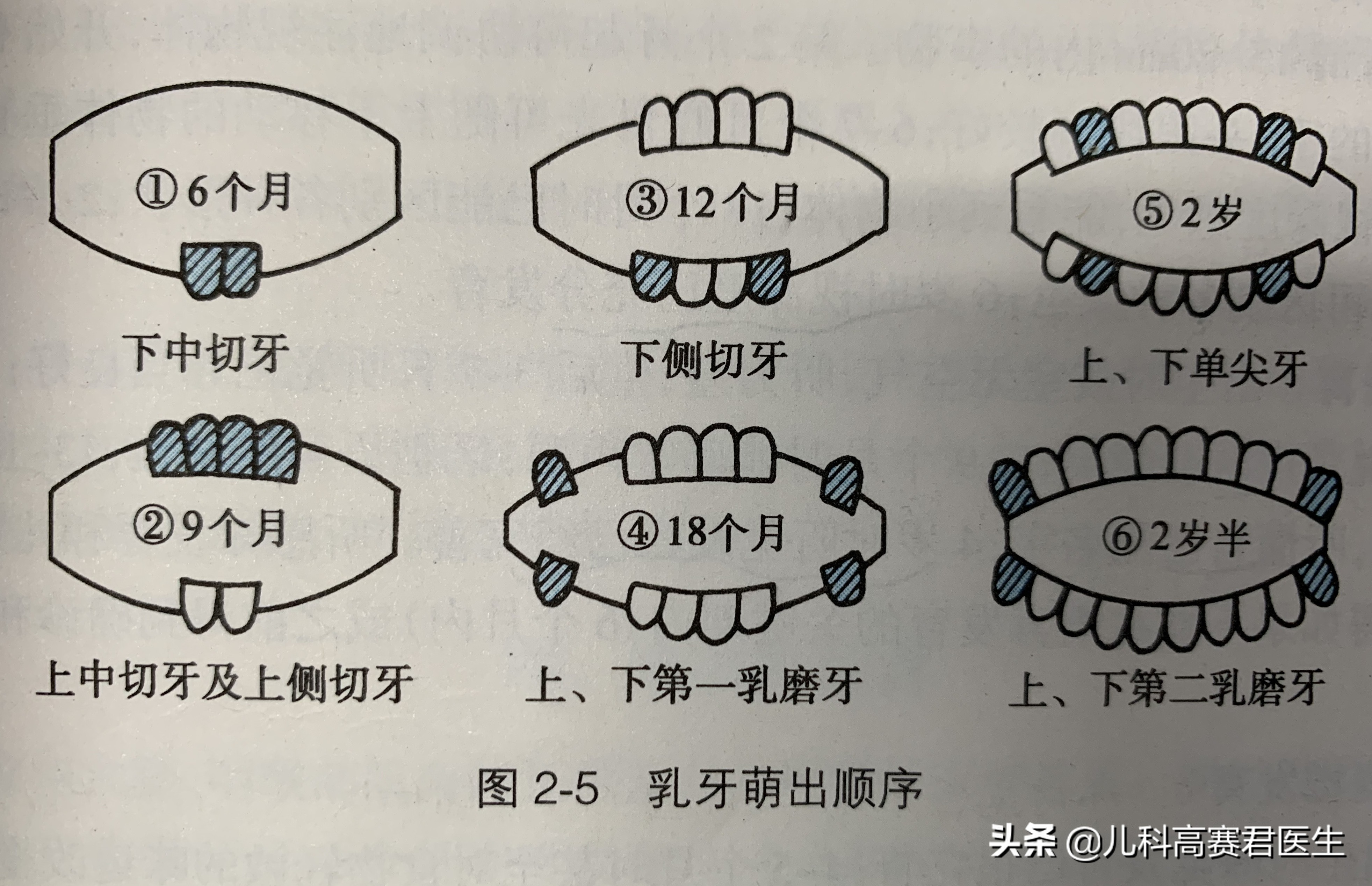 宝宝出牙全攻略，出牙会引起发热吗？