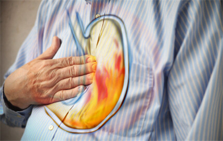 烧心吃什么药 烧心最怕三种食物-文化号