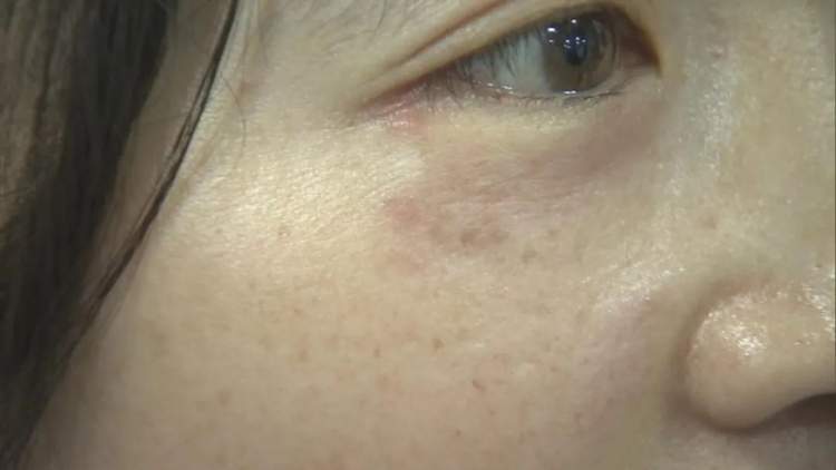 时暖时寒，皮肤是不是变“娇气”了？专家来支招