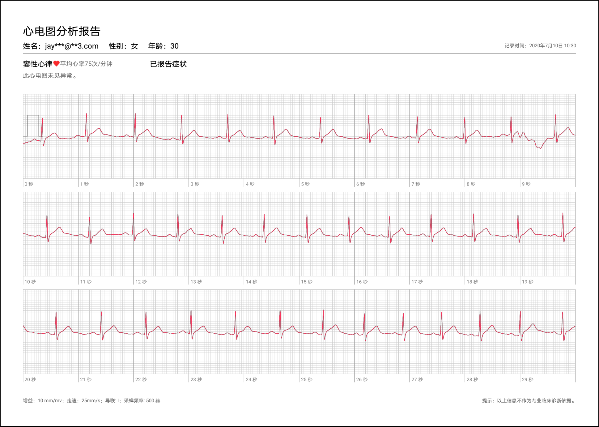 华为手表测心率与实测差别大（华为手表心率监测准吗）-第9张图片-大连信息网