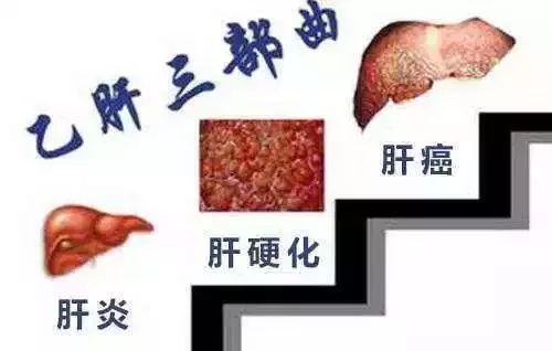 艾滋病、乙肝、梅毒，能通过这些途径传播，很多人却不知道