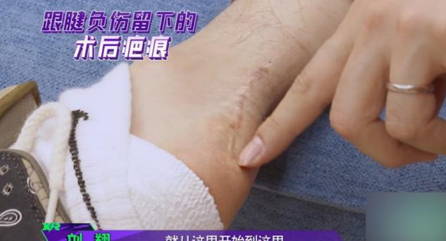刘翔做的是什么手术(刘翔罕晒跟腱术后疤痕，长达5厘米伤疤触目惊心，网友直呼心疼)