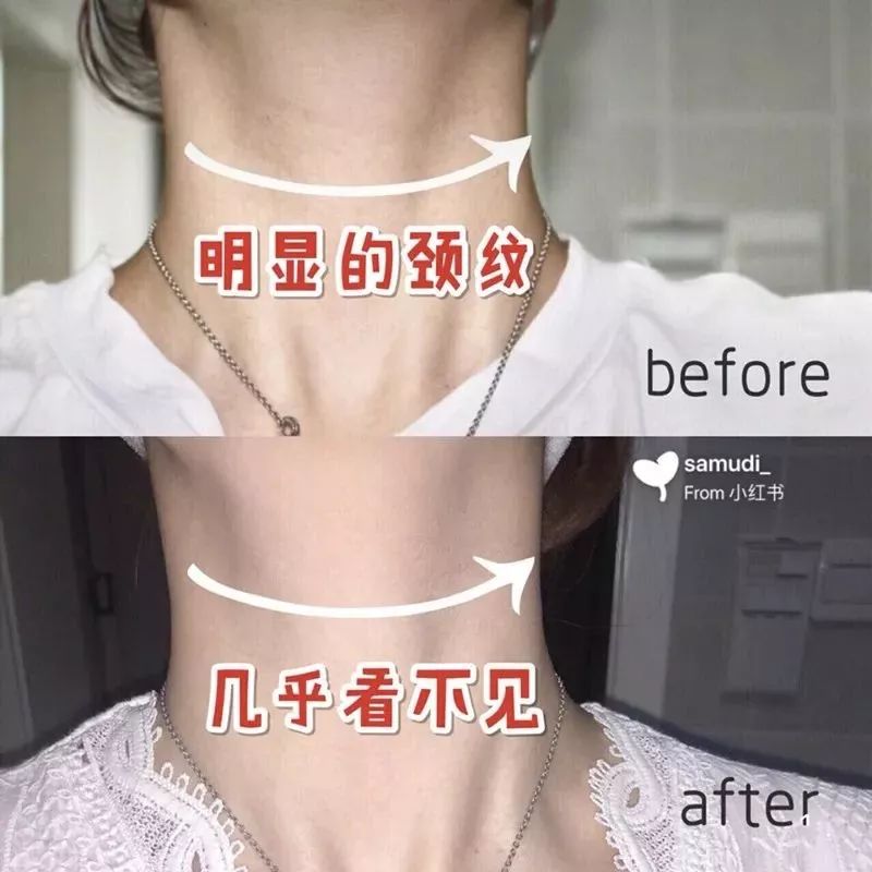 自己在家就能做的“面部提拉法”,紧致嫩肤,提拉瘦脸,简单易学