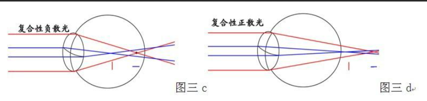 網(wǎng)上眼鏡選購指南，驗光，鏡片鏡架選擇總攻略