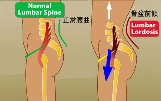 一个人怎么练习打网球(初学瑜伽身体僵硬不灵活，一个网球让你放松肌肉，舒缓身心)