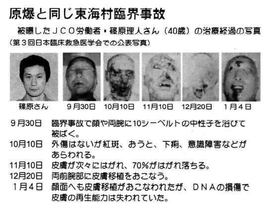 被輻射污染的動物吃不得，用輻射殺菌的食品就可以吃嗎？