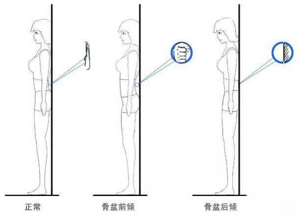 怎么判断骨盆是否正位?教你用一只手自测