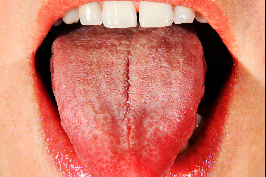 舌头的颜色反应健康信息,知道了不用看医生