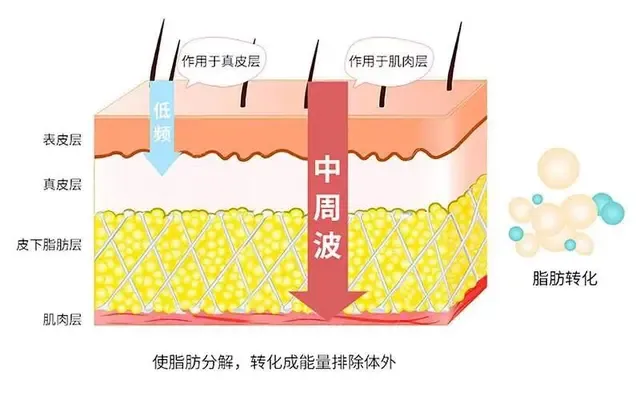 跳绳1000下能消耗多少卡路里（学会2个方法才能真正降体脂!）-第7张图片