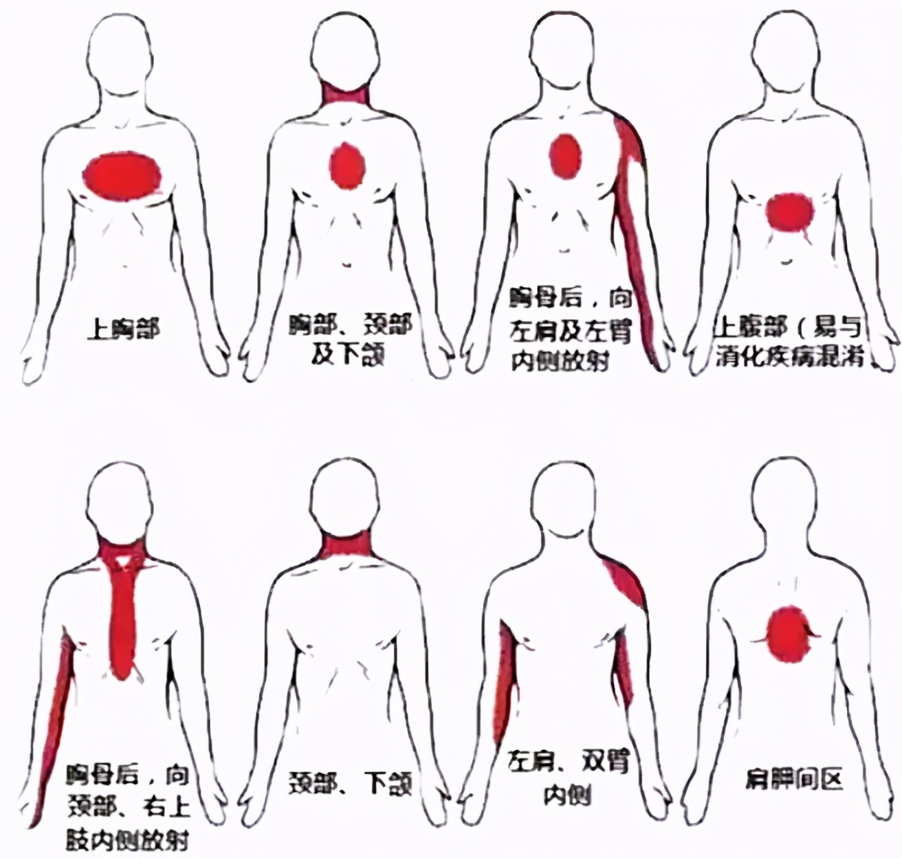 @心内科医生：胸口一阵刺痛，是心脏出问题了吗？