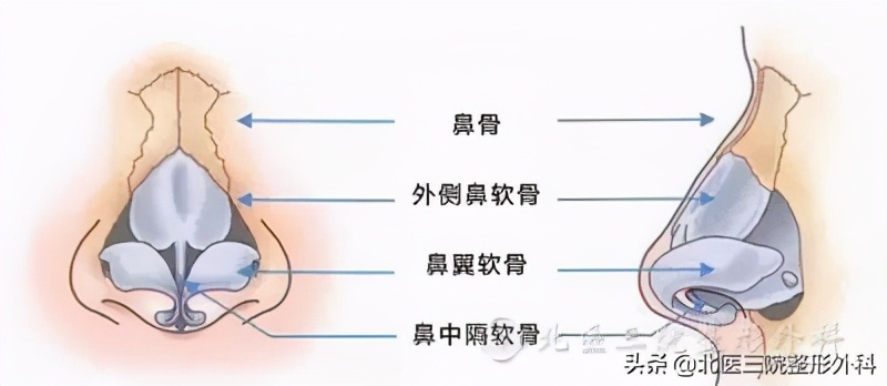 长了一个歪鼻子需要整形吗