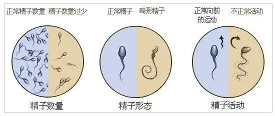 3分钟带你看懂精子化验报告