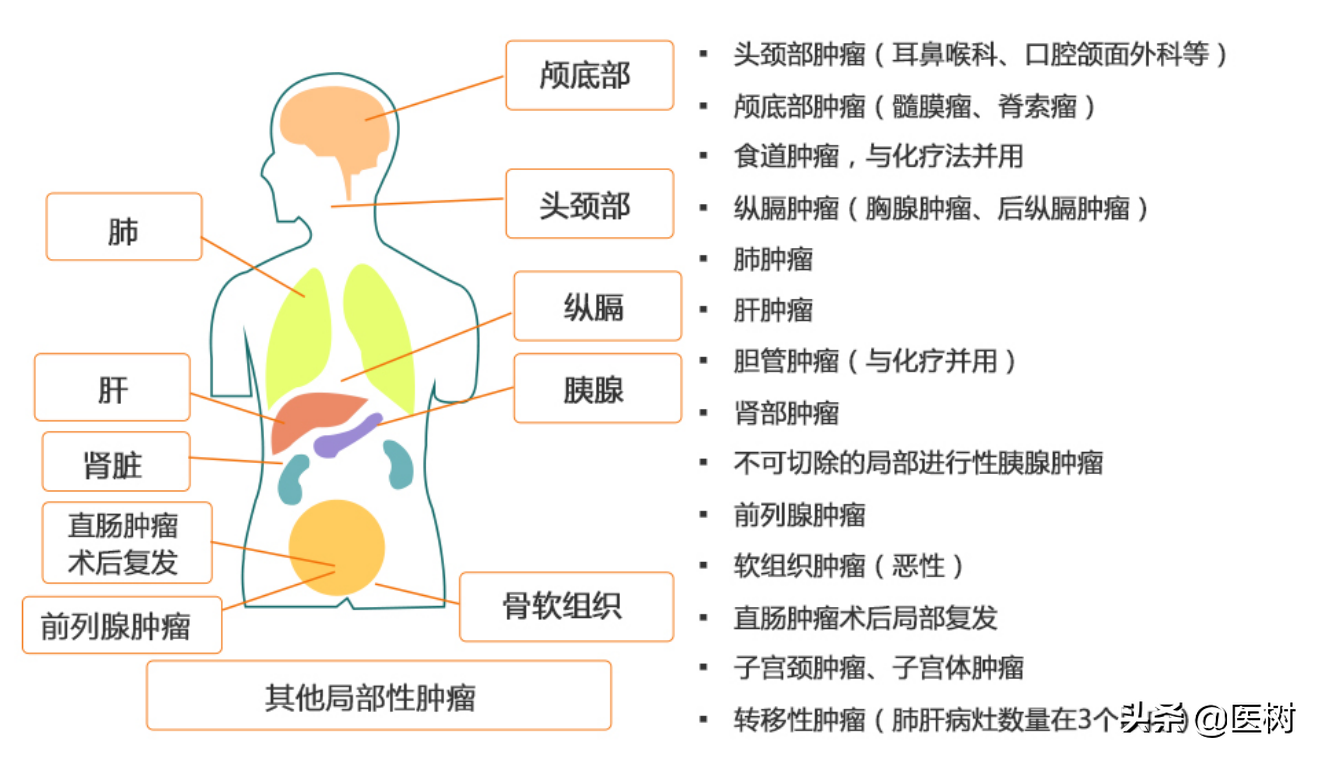 果断、干脆！直接打断癌细胞DNA，射线治疗为何如此豪横？