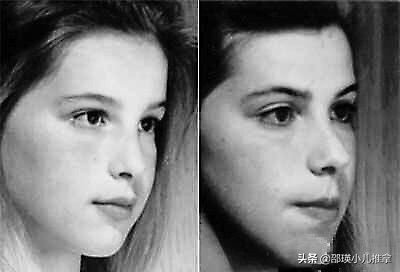 孩子腺样体肥大，怎么调理才有效？