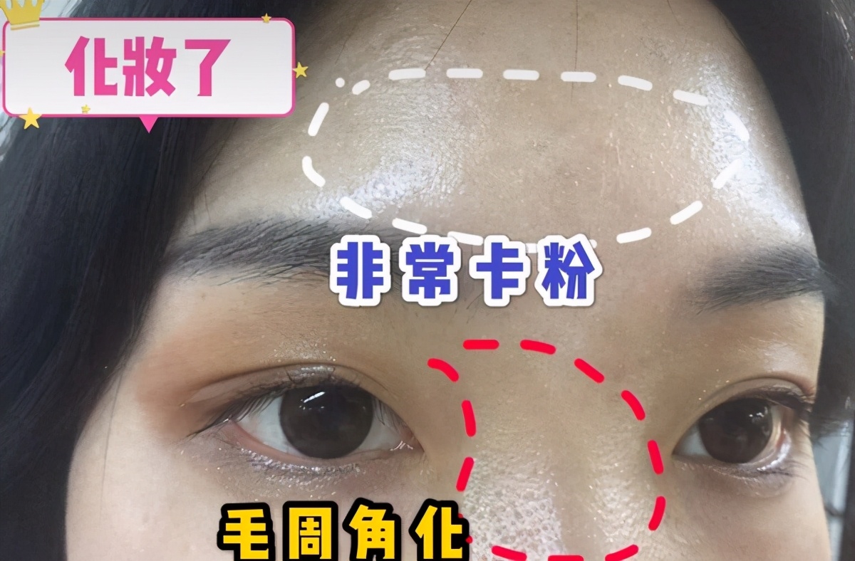 化妆卡粉严重怎么办？快速补救技巧分享