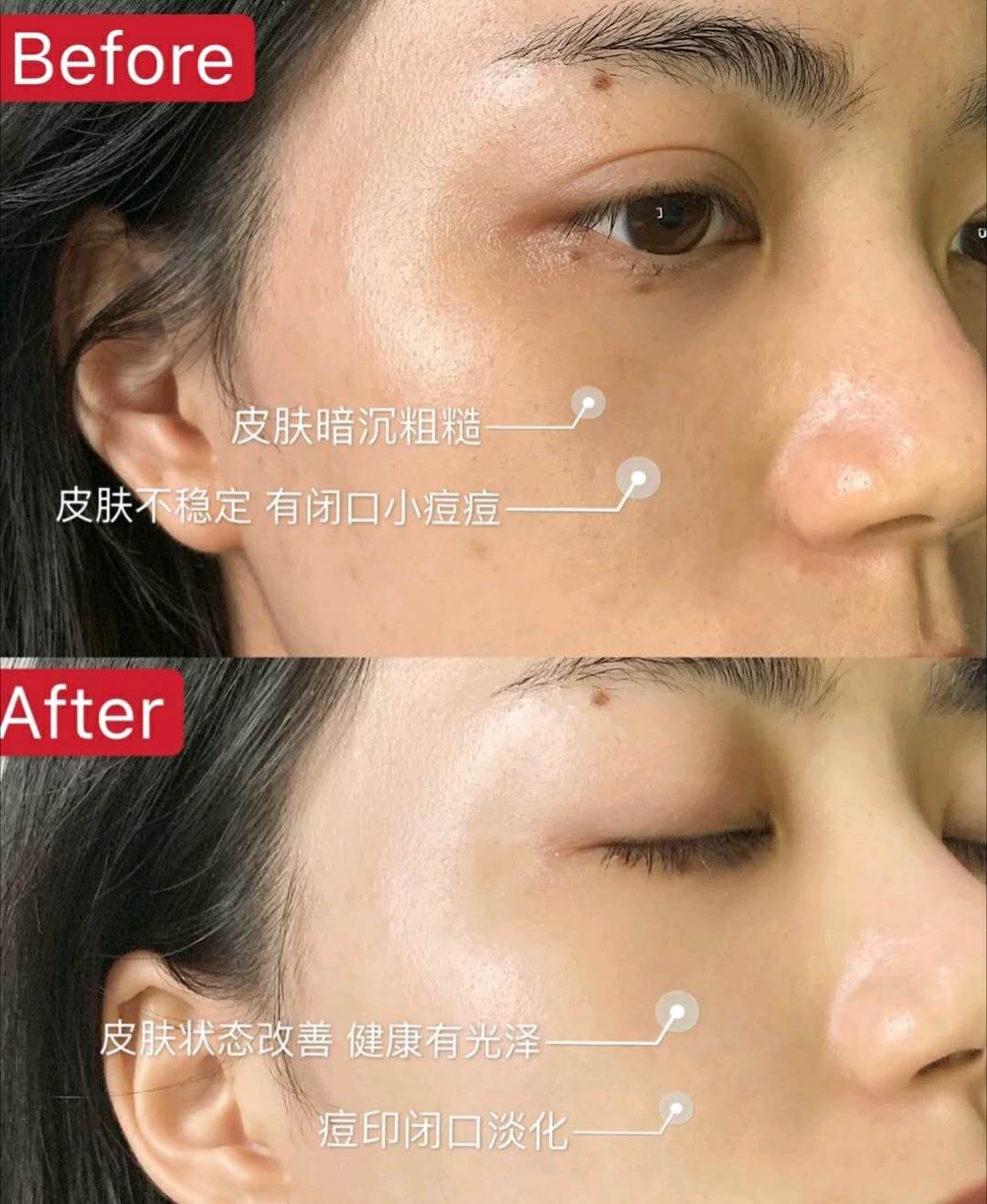 雅诗兰黛精(jing)华液的正确使用方法（雅诗兰黛(dai)眼霜的正确使用(yong)方法）-第7张图片(pian)-扬帆股票网