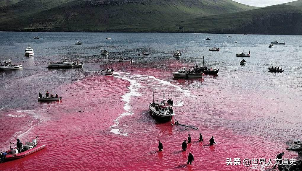 腳氣病為什么叫腳氣病 探尋腳氣病的歷史和起源