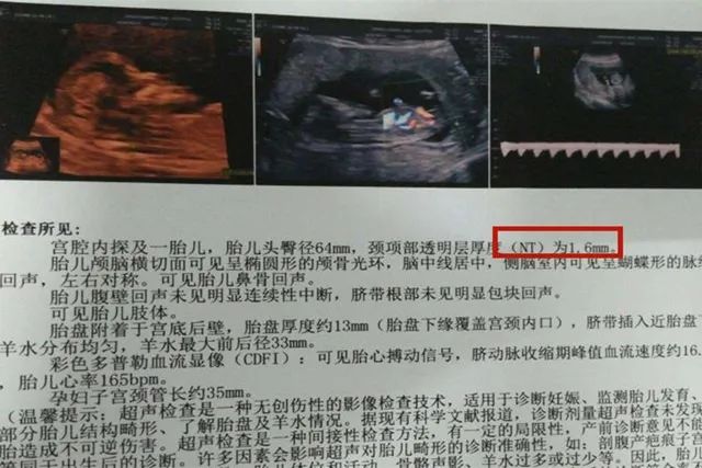 怀孕3个半月，B超发现是女孩被迫流产，你可曾想过胎儿会不会疼
