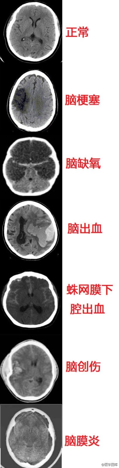 神经元结构示意图（神经元结构示意图手绘）-第31张图片-科灵网