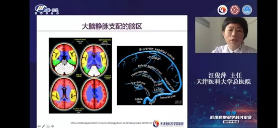 北京大学滨海医院成功举办京津影像病例多学科讨论会