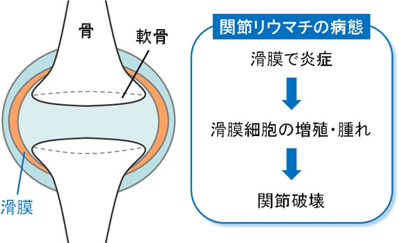 老人膝盖疼是怎么回事（小心6种疾病个个危害巨大）