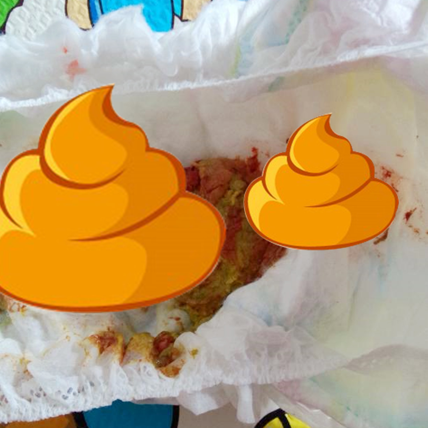 婴儿在床上拉屎视频(宝宝拉出这种) - 乐宝宝贝