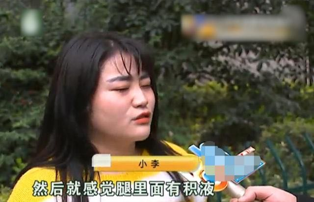 女子花50000元做腿部抽脂手术，如今怎么样了？看完不敢做