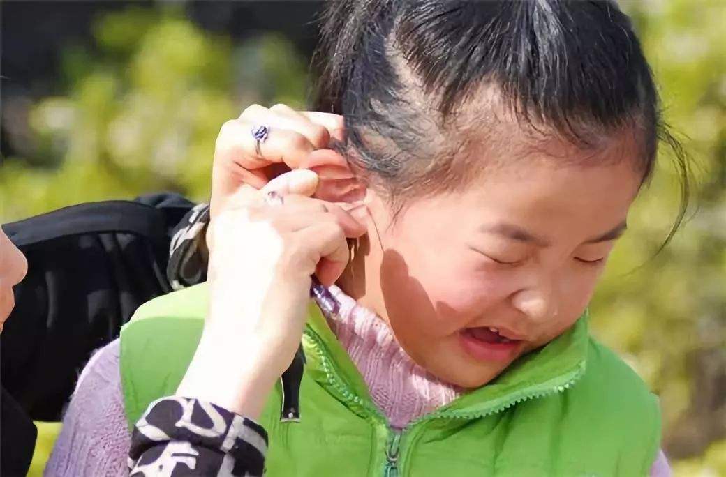 女儿总挠耳朵听不清楚,医生用手电筒一照斥妈妈:怎么才来?