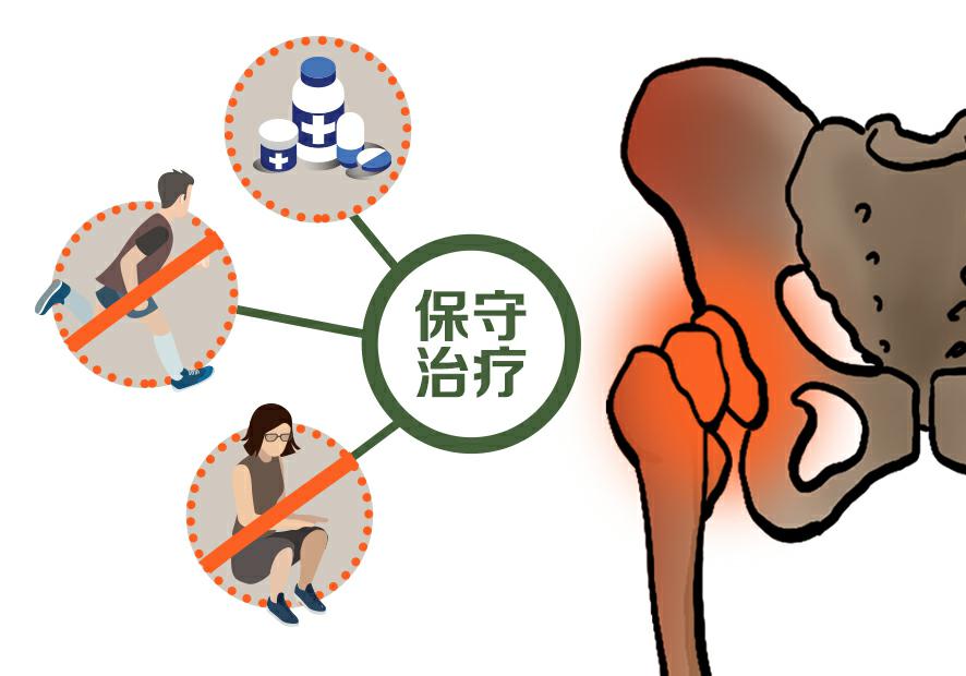 走路走久了胯耻骨就疼，究竟怎么回事？