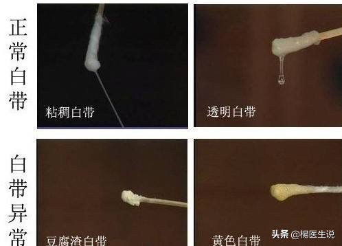 女性健康,是一个说来说去的老问题了,在日常生活中我经常遇到过女性