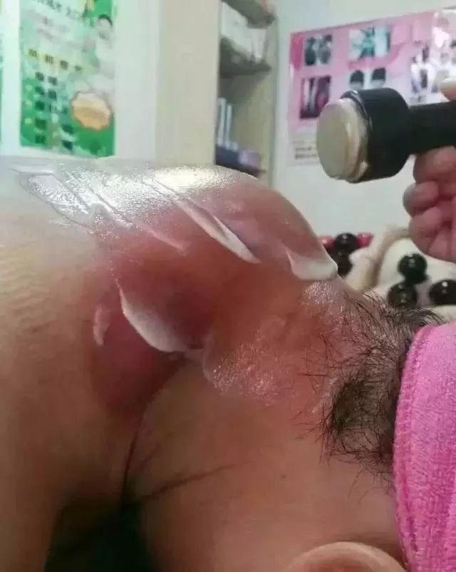 这个穴位堵塞很危险，在年轻人中很普遍