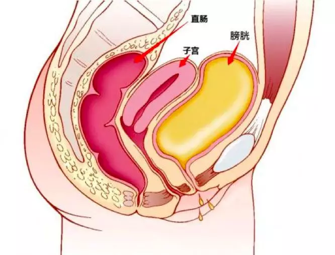 得了子宫肌瘤，必须要手术吗？