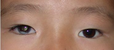 4个月婴儿倒睫毛怎么办(婴幼儿眼睛要注意什么) - 乐宝宝贝