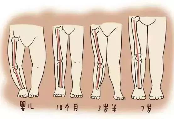 蹲不下、胳膊举不直，右侧腰骶疼痛，可能是长短腿，几个动作纠正