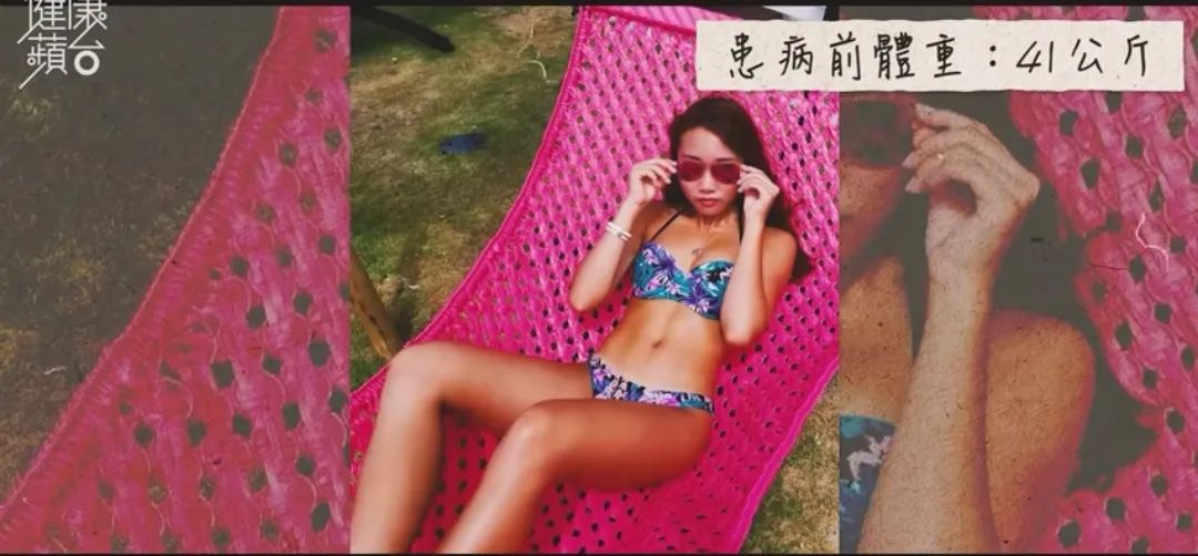 00后英国留学患病暴肥19kg，停止减肥才是出路？