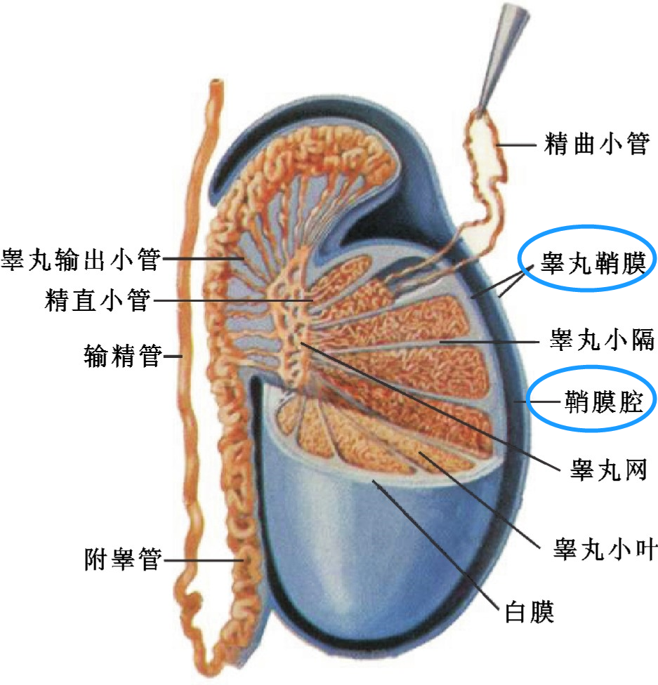 男寶鞘膜積液是如何形成的?